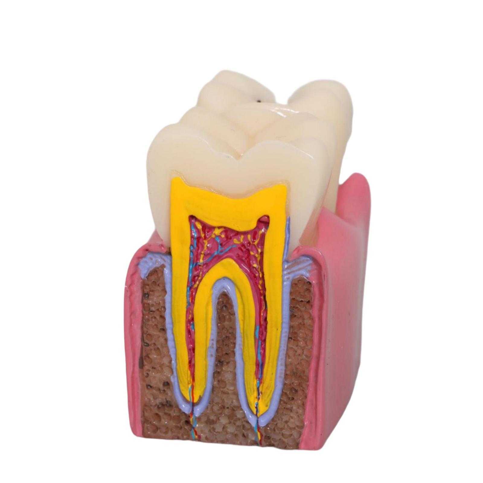 Modelo de caries dental, utile - Kids Education Classes reseña y precio